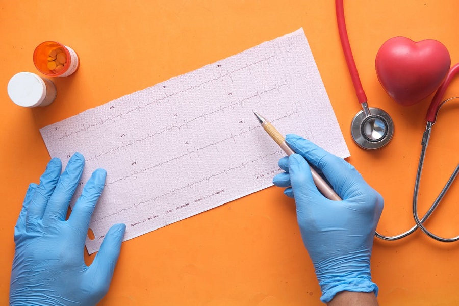 Ce este EKG